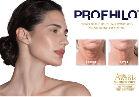 Profhilo® Skin Moisturising Treatment - Age Repair