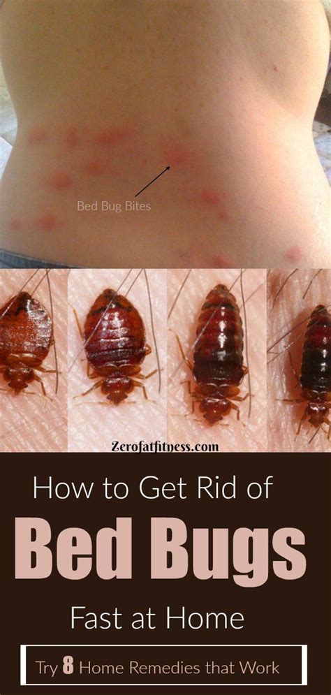 How To Get Rid Of Fleas In Bed Mattress