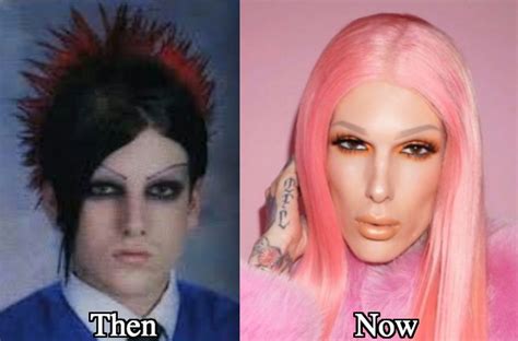 Jeffree Star Before Photos - werohmedia