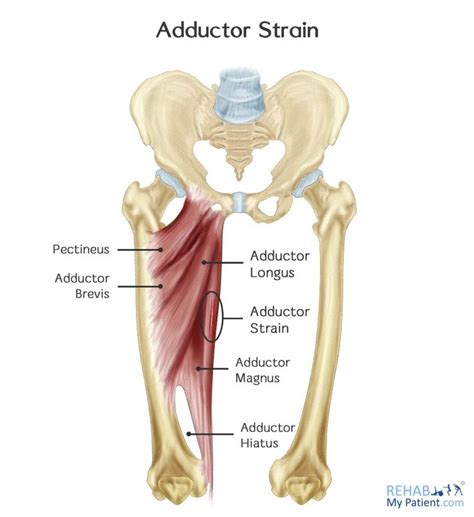 The adductor muscles are a group of three thin muscles that run along ...