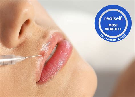 Botox Lip Flip vs. Lip Filler: Pain Level & Results | RealSelf News