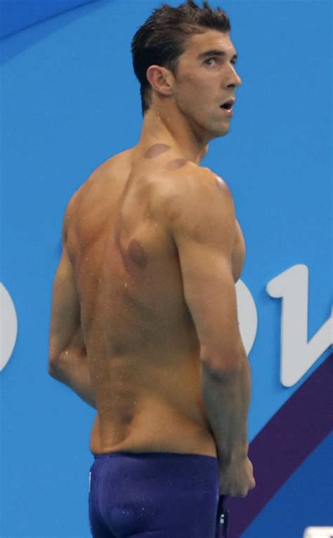 Michael Phelps and 7 More Stars Who've Tried Cupping