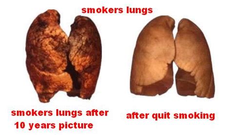 smokers lungs cancer