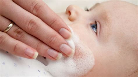 Baby acne FAQ: Symptoms, treatment and different types - Today's Parent