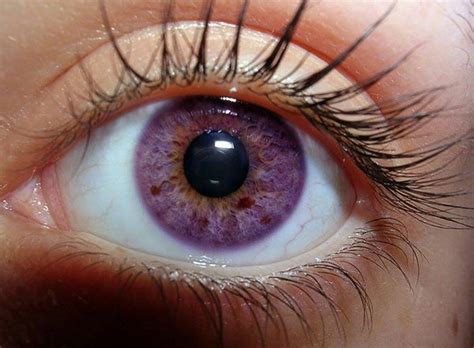 7 Rarest and Unusual Eye Colors That Look Unreal