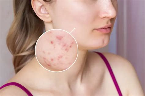 Skin allergies - IPAL CLINIC