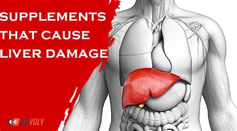 Can Weight Loss Supplements Cause Liver Damage? - MeVolv