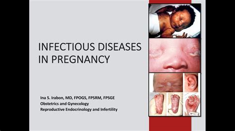 INFECTIOUS DISEASES IN PREGNANCY - YouTube