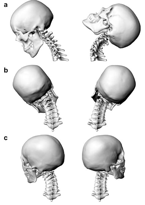 Registered 3D C0-T1 cervical spine models of a subject in different ...