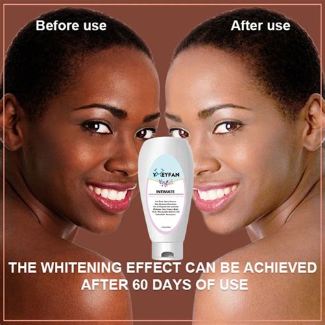 Skin Bleaching Products For Black Skin