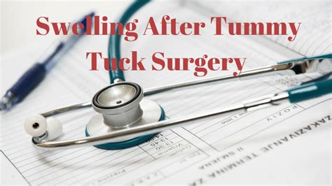 Swelling after Tummy Tuck Surgery? - Cherup, Lori (drcherup.com)