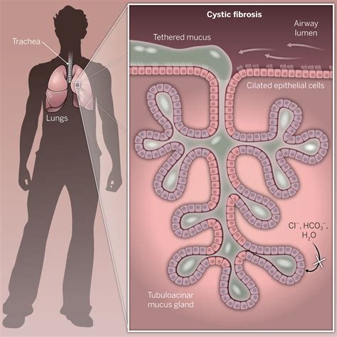 Mucus In Lungs