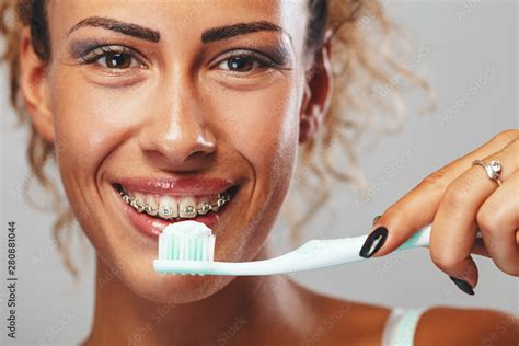 Brushing Teeth With Braces Stock Photo | Adobe Stock