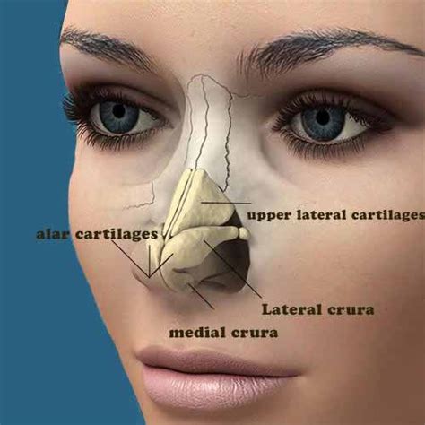 Correction of hanging columella by rhinoplasty - symptoms and causes