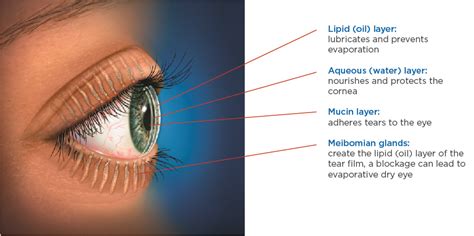 Dry Eye Center