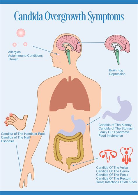 Cleanse Your Colon – The Definitive Guide Share Tweet Share Share A ...