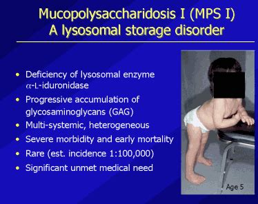 Mucopolysaccharidosis Type 1 (MPS 1) | CheckRare.com