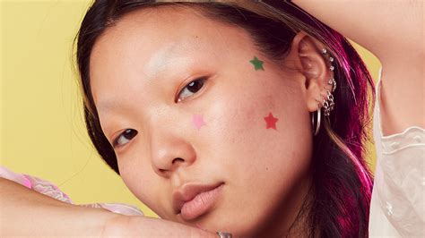 The zit sticker war - Glossy