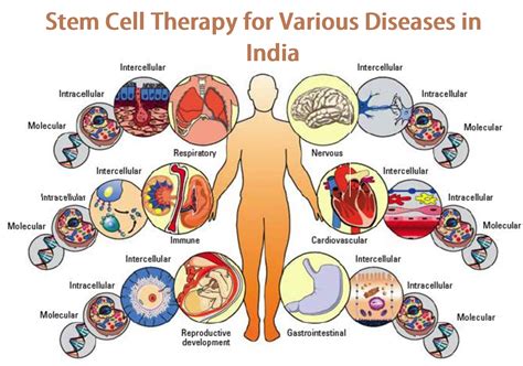 Stem Cell Therapy for Various Diseases in India with Tour2India4health ...