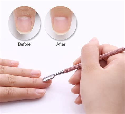 Cuticle Remover