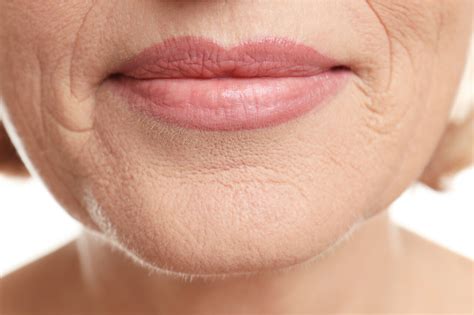 How to get rid of wrinkles around mouth edges? What care the causes?