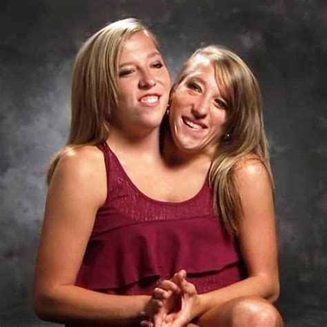 Conjoined twins Abby and Brittany Hensel married | Conjoined twins ...