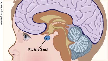 Craniopharyngioma (for Parents) | Nemours KidsHealth