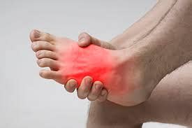 Causes of Synovitis in the Foot and Ankle - Hurst Podiatry