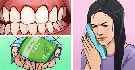 Soothe the pain of irritated and swollen gums with these 7 home remedies