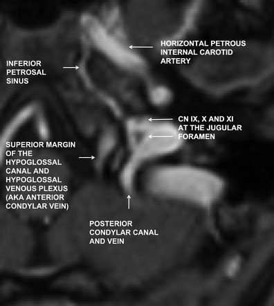 Image | Radiopaedia.org