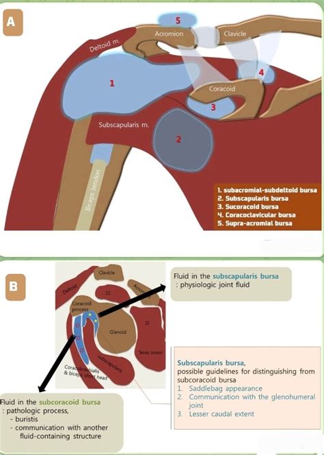 𝐃𝐫.𝐎𝐌𝐈𝐃 𝐁𝐀𝐍𝐃𝐀𝐑𝐂𝐇𝐈, 𝐌.𝐃. on Twitter: "Image A: 🛑Bursa aorund shoulder ...