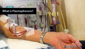 What Is plasmapheresis? Procedure, Side Effects, Cost And More By Dr. Ahmed