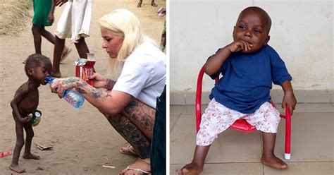 2-Year-Old ‘Witch Child’ Who Was Left To Die Makes Stunning Recovery ...