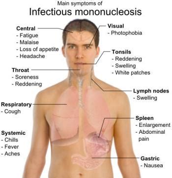 urgent care mono test - phil-hotek