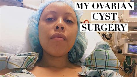 3CM OVARIAN CYST REMOVED IN LAPAROSCOPIC SURGERY - YouTube