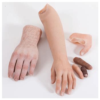 PARTIAL HAND PROSTHESIS | Bornlife Prosthetic