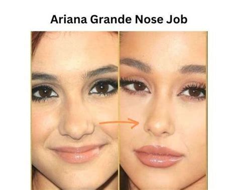 Ariana Grande Plastic Surgery - All Details Revealed! | Fabbon