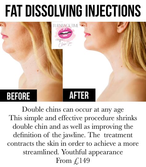 Fat Dissolving Injections in Exeter - Changing Faces Studio