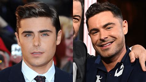 Zac Efron Face Before & After Jaw Surgery, Plastic Surgery, Filler ...