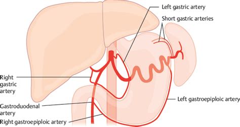 Gastric Arteries | Radiology Key