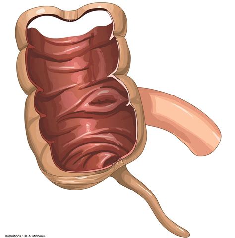 Ileocecal Valve Model