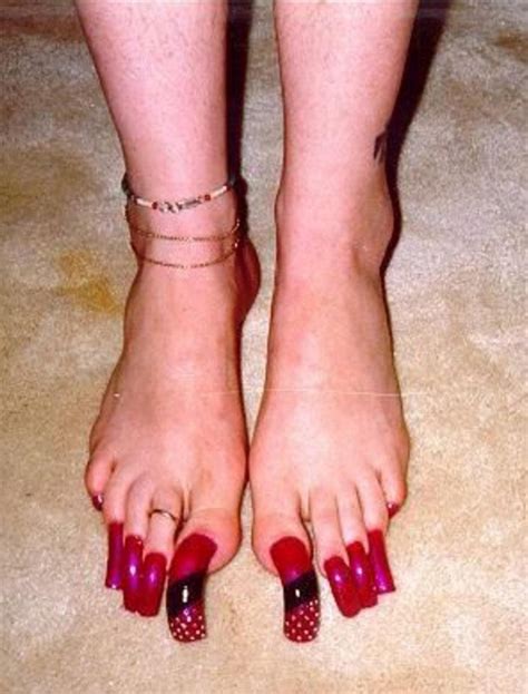 12 photos des pires pieds au monde