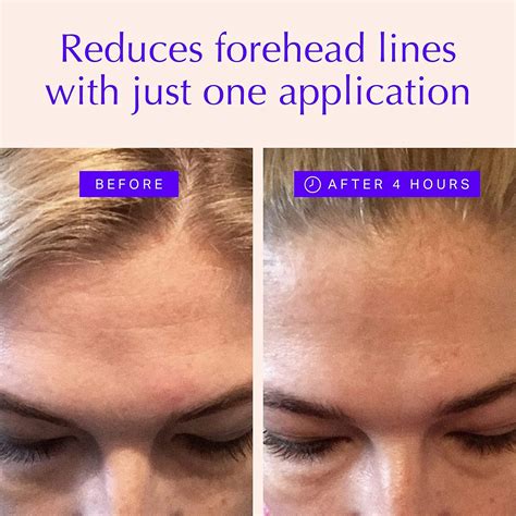 Forehead & Eye Wrinkle Patches - Overnight Anti-Wrinkle Treatment ...