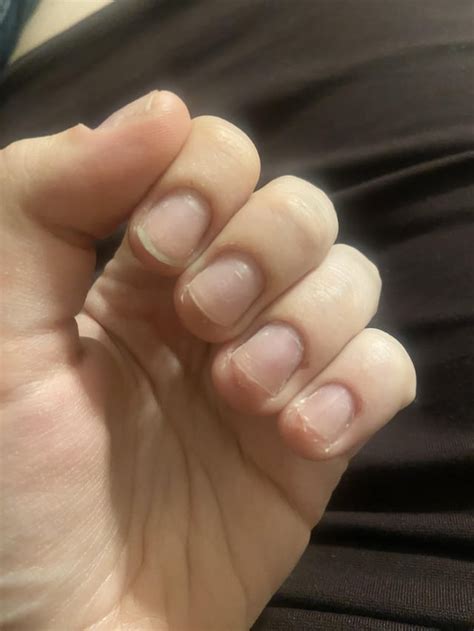 Allergic to Apres Gel X and I’m DEVASTATED. I need some help. : r/Nails