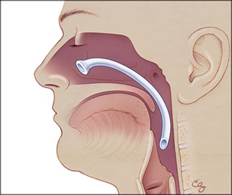 Nasopharyngeal Airway Anatomy