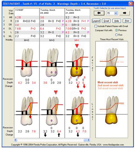 Florida Probe | Tampa, FL | Tampa Bay Periodontics