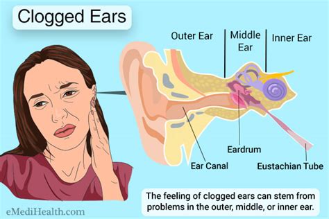 Icd 10 Code For Middle Ear Effusion