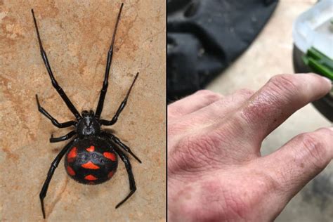 How Dangerous Are Black Widow Spiders?