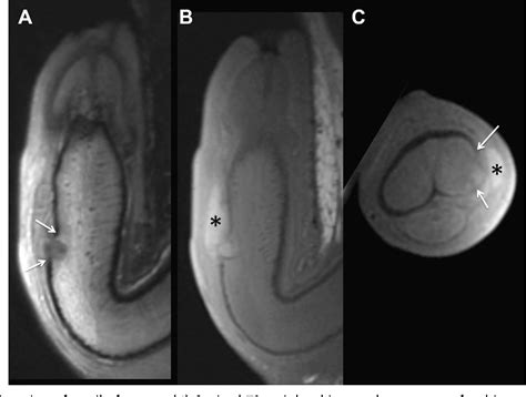 Figure 7 from Imaging of male pelvic trauma. | Semantic Scholar