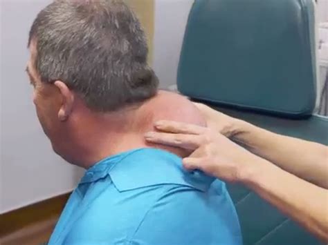 Watch Dr. Pimple Popper treat a man's cantaloupe-sized back hump, which ...